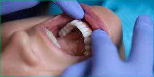 Dental Checkup Consultation